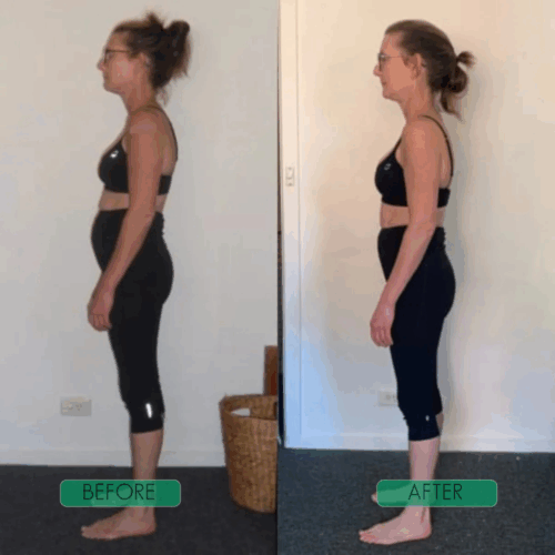 Corecare Posture Corrector (Official Retailer) 2025